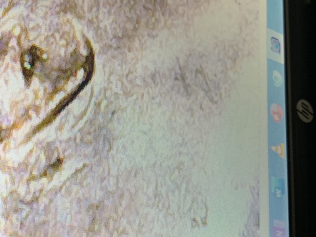 Need-Help-Verifying-A-2018-D-Lincoln-Cent-Doubled-Ear
